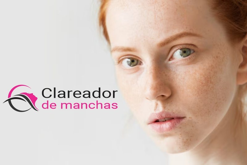 Clareador de Manchas Faciais